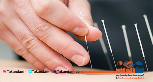 acupuncture-benefits-3
