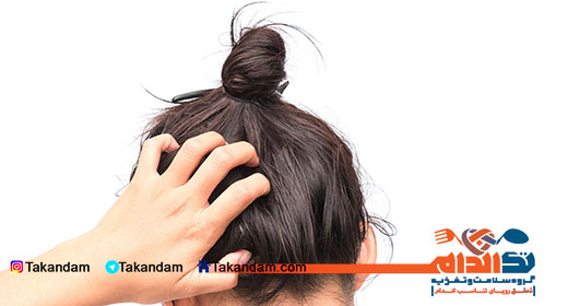 head-lice-essential-symptoms