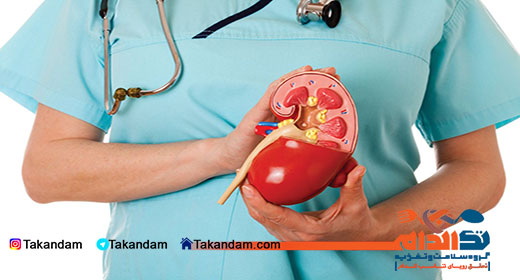 kidney-transplantation-kidney-disease