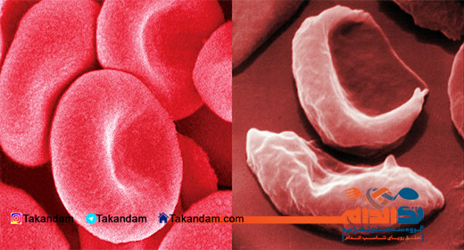 anemia-symptoms-blood