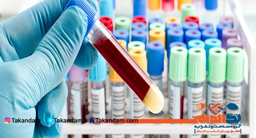 Hormone-Therapy-test