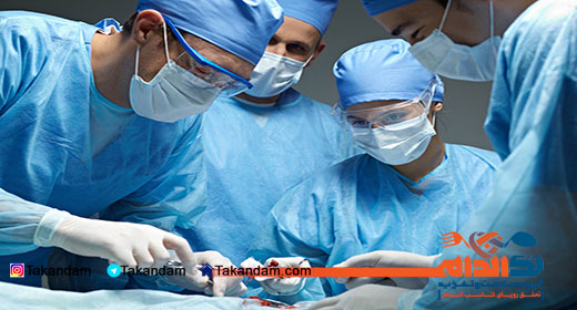 Sleeve-gastrectomy-surgery