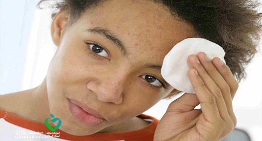 What%E2%80%99s-Causing-My-Pimple-warm-compress