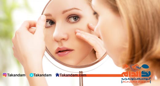 acne-cause-and-treatments-poking