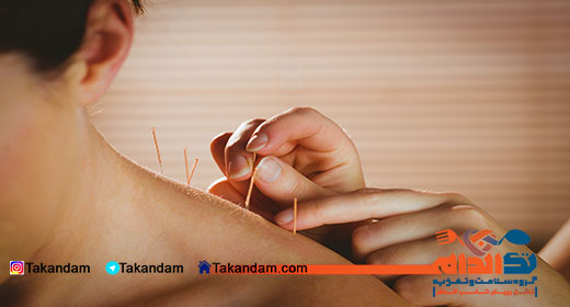 acupuncture-benefits-4