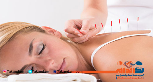 acupuncture-benefits-6