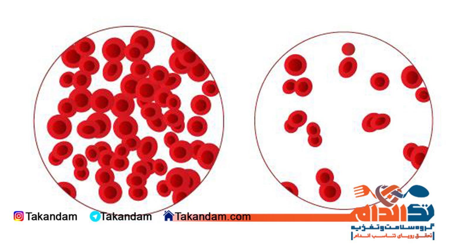 anemia-reasons