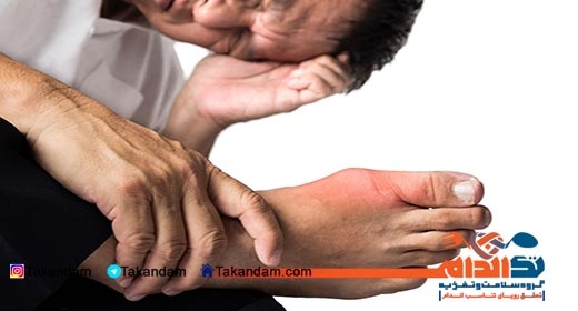 arthritis-foot