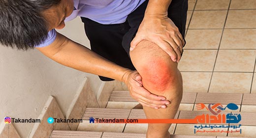 arthritis-knee