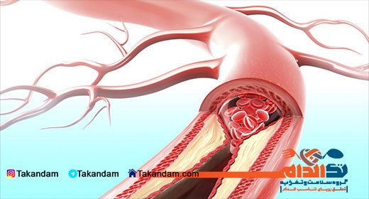 blood-clot-remedy-1