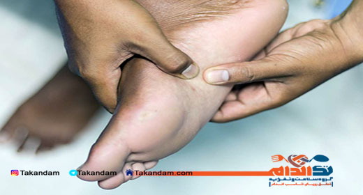 bone-cysts-feet