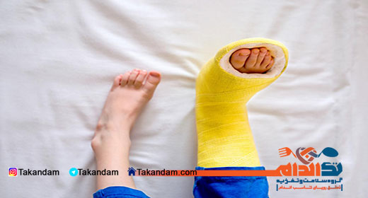 bone-cysts-fracture