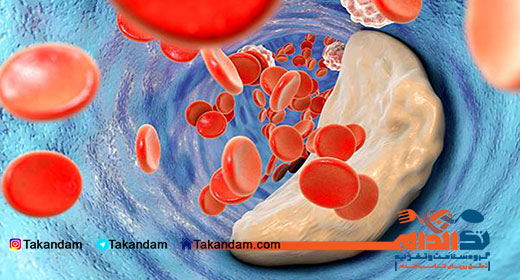 cholesterol-level-accumulation