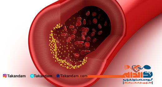 cholesterol-level-vessels