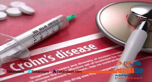 crohns-disease-diagnosis