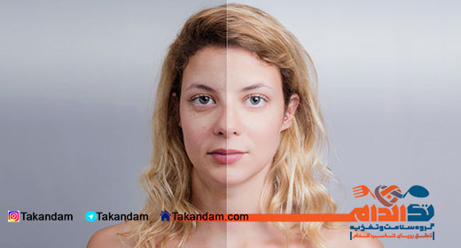 cucumber-and-skin-dull-skin