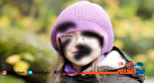 degeneration-macular-3