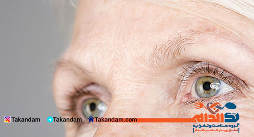 degeneration-macular-4