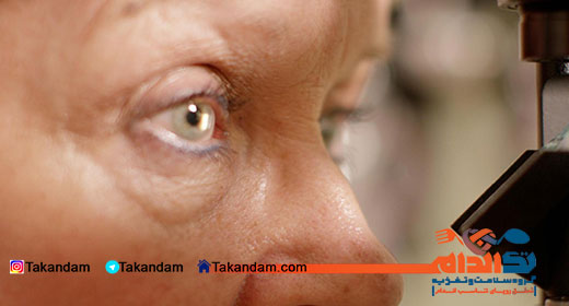 degeneration-macular-diagnose