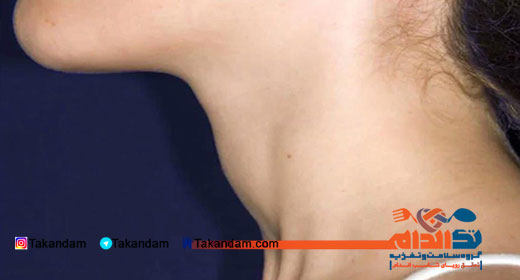 diagnose-thyroid-glands