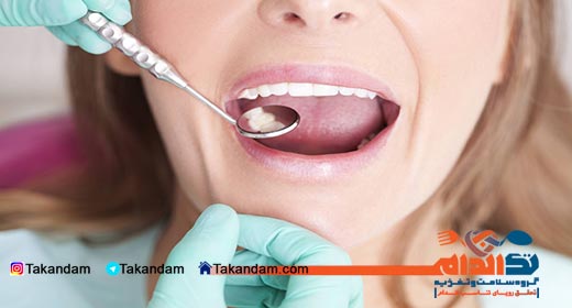 dry-lips-prevention-teach-checkup