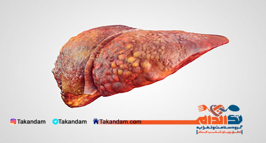 fatty-liver-liver