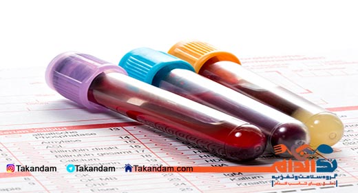 gastric-bypass-surgery-blood-samples