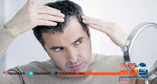 hair-loss-checking