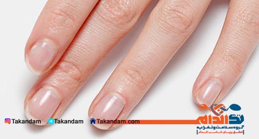 leukonychia-cause-and-treatment-1