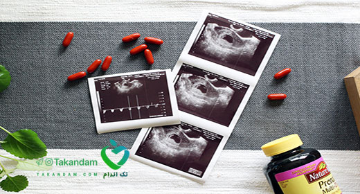 multivitamins-during-pregnancy