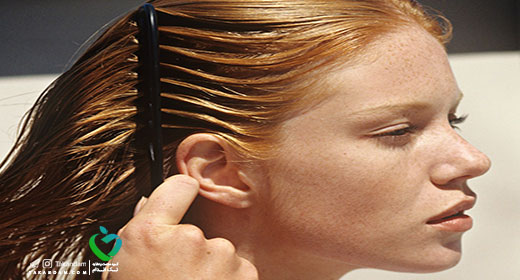 oily-hair-2