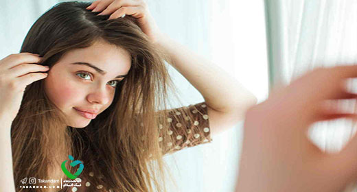 oily-hair-3