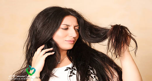 oily-hair-4