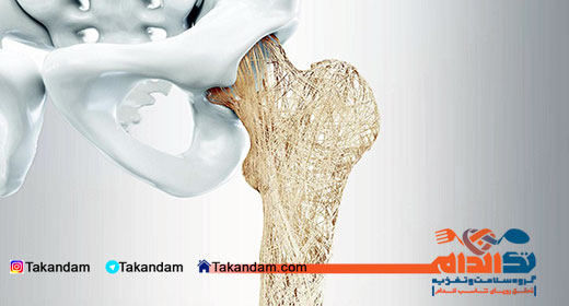 osteoporosis-cause-1