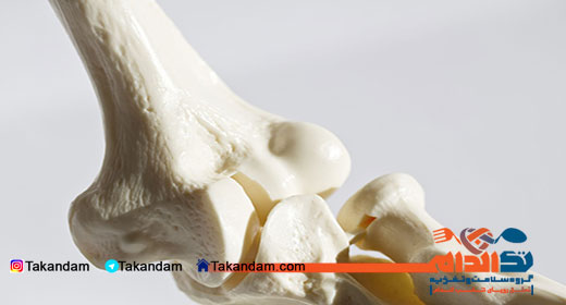 osteoporosis-cause-2