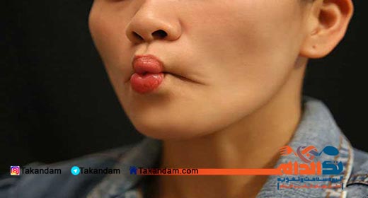 puffy-face-face-message
