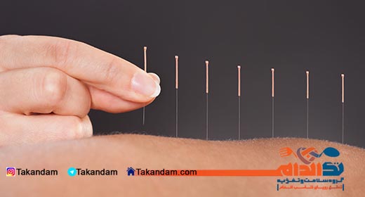 sore-throat-remedy-acupuncture