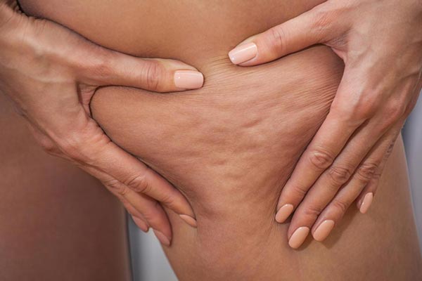 ده ماده غذایی که با سلولیت مقابله می کند